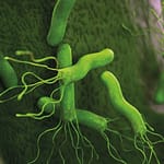 Helicobacter pylori: cuando el diagnóstico oportuno puede hacer una enorme diferencia