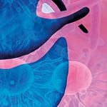 Pericarditis purulenta por Mycobacterium tuberculosis y Streptococcus pneumoniae. Revisión del tema, a propósito de un caso