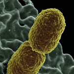 Resistencia antimicrobiana de Enterobacterias causante de infección del tracto urinario en pacientes ambulatorios