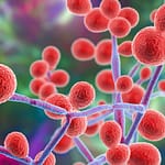 Susceptibilidad in vitro a antifúngicos de especies de Candida