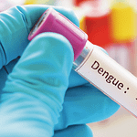 Elección de la metodología adecuada para el diagnóstico de dengue
