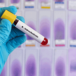 MEDICIÓN DE B-HIDROXIBUTIRATO DIAGNÓSTICO CLAVE PARA TRASTORNOS METABÓLICOS