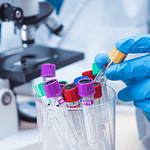 Surgimiento y evolución de los sistemas de normalización para laboratorios clínicos