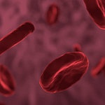 Hemoglobinuria paroxística nocturna: Una causa infrecuente y tratable de lesión renal aguda. Caso clínico
