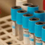 Atención Bioquímica en Medicina Regenerativa: El Rol Clave del PRP y el Profesional Bioquímico