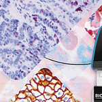 automatización de la inmunohistoquímica con tecnología avanzada