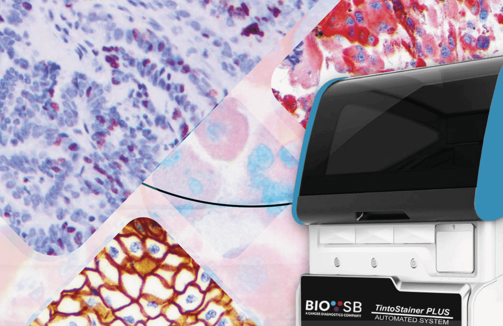 automatización de la inmunohistoquímica con tecnología avanzada