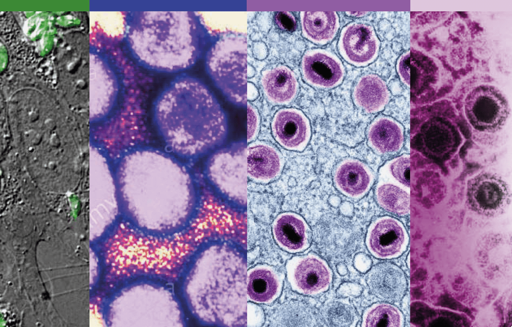 Nuevos productos para la automatización de la detección de anticuerpos del complejo ToRCH