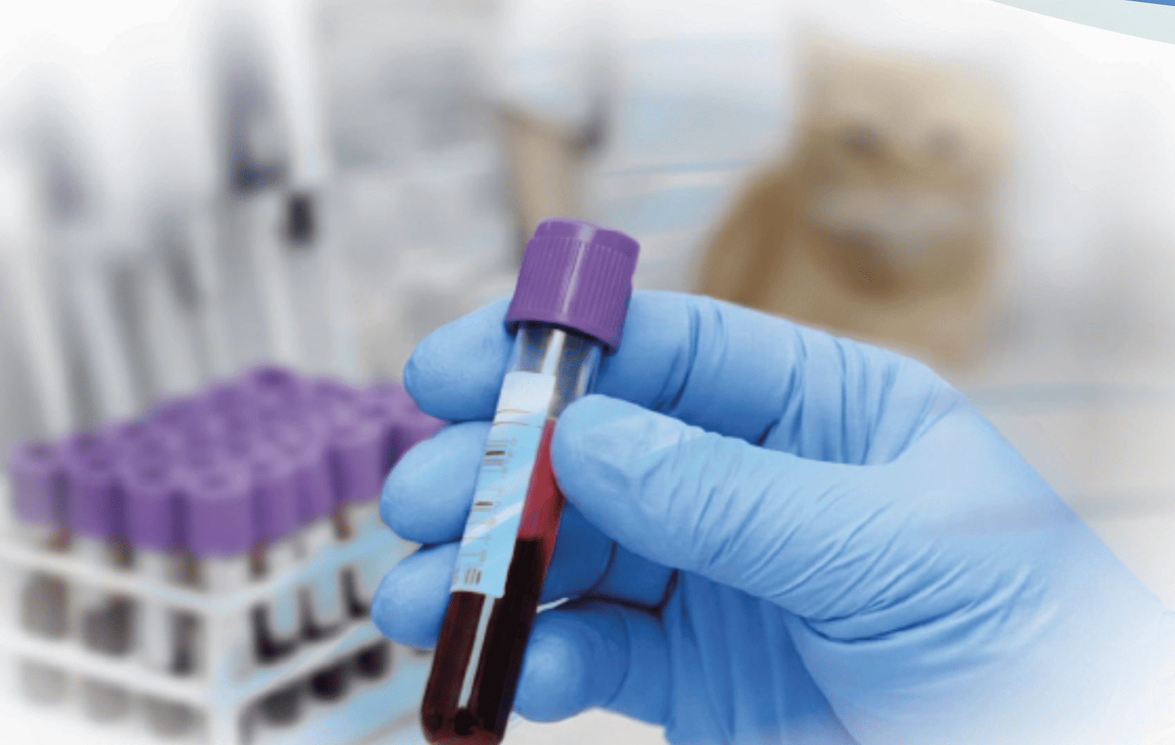 Diagnóstico veterinario para el laboratorio clínico