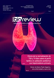 Efecto de la normalización de TSH y T4 libre sobre el perfil lipídico en población pediátrica con hipotiroidismo primario