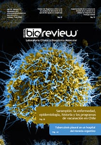Sarampión: la enfermedad, epidemiología, historia y los programas de vacunación en Chile