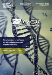 Resultados de seis años de estudios citogenéticos en líquido amniótico