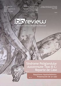 Síndrome Poliglandular Autoinmune Tipo III C