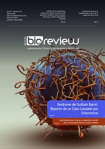 Síndrome De Guillain Barré: Reporte De Un Caso Causado Por Enterovirus