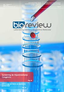 Sobrecarga de hierro en pacientes pediátricos