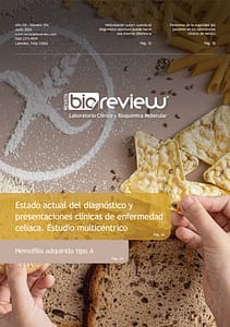 Estado actual del diagnóstico y presentaciones clínicas de enfermedad celíaca. Estudio multicéntrico