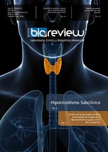 Hipotiroidismo Subclínico