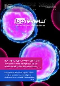 HLA DRB1*, DQB1*, DPA1* y DPB1* y su asociación con la patogénesis de las leucemias en población venezolana