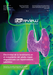 Efectividad de la levotiroxina en el tratamiento del adulto mayor diagnosticado con hipotiroidismo subclínico