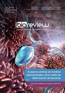 El plasma seminal de hombres vasectomizados como medio de diseminación de bacterias