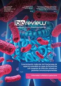 Caracterización molecular de Beta-lactamasas de espectro extendido en cepas de Escherichia coli causantes de infección urinaria en pacientes inmunocomprometidos.