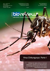 Virus Chikungunya