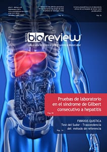 Pruebas de laboratorio en el síndrome de Gilbert consecutivo a hepatitis