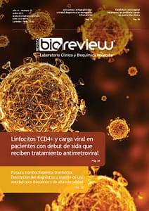 Linfocitos TCD4+ y carga viral en pacientes con debut de SIDA que reciben tratamiento antirretroviral