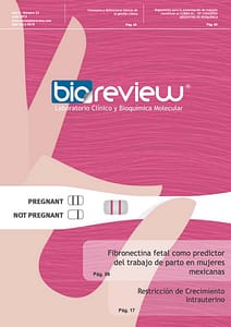 Fibronectina fetal como predictor del trabajo de parto en mujeres mexicanas