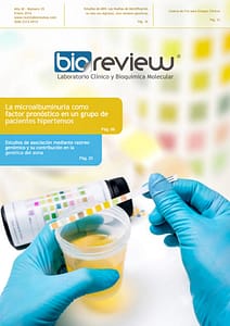 La microalbuminuria como factor pronóstico en un grupo de pacientes hipertensos de una entidad de primer nivel