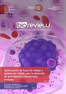 optimización de flujos de trabajo y paneles de cribado para la detección de gammapatías monoclonales