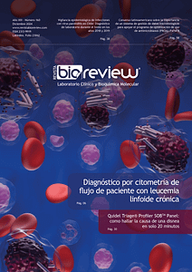 Diagnóstico por citometría de flujo de paciente con leucemia linfoide crónica