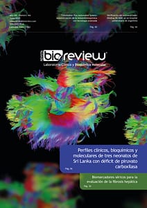 Perfiles clínicos, bioquímicos y moleculares de tres neonatos de Sri Lanka con déficit de piruvato carboxilasa