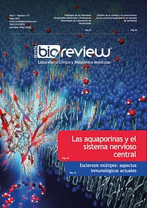 Las aquaporinas y el sistema nervioso central