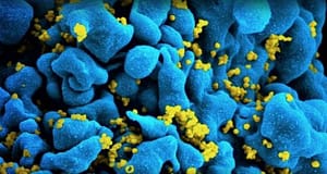 Árbol de decisión para la determinación precisa del momento de la infección en individuos recientemente diagnosticados con infección por VIH-1