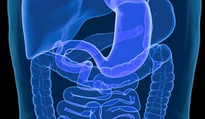 Perfil clínico y evolutivo de la enfermedad de Crohn en el Hospital Rebagliati (Lima-Perú)