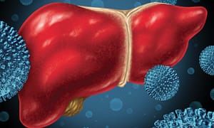 Hepatitis por citomegalovirus. Importancia del momento de contagio