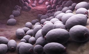 Evaluación del rendimiento de 1,3-Beta-dglucano como apoyo diagnóstico de infecciones invasoras por Candida spp. en pacientes críticos adultos