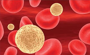 Neutropenia inducida por quimioterapia en pacientes con cáncer de mama