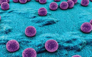 Bacteriemias por Staphylococcus aureus: Factores de Riesgo Asociados a la Resistencia a Meticilina
