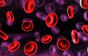 Técnicas de citogenética y biología molecular para el diagnóstico y seguimiento de la leucemia promielocítica
