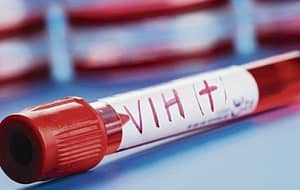 Seropositividad de VIH y factores asociados en donantes de un Banco de Sangre de La Ciudad de Medellín - Colombia, 2005 – 2018
