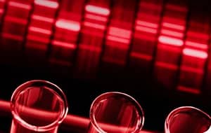 Introducción de la técnica PCR-RFLP para el diagnóstico de dos mutaciones en el gen VHL
