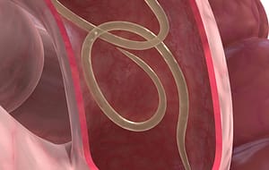 Toxocariasis en edad pediátrica. Presentación de un caso