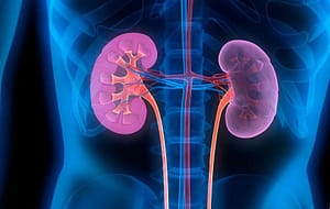 Toxinas unidas a proteínas: valor añadido en su eliminación con altos volúmenes convectivos