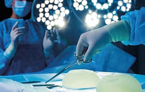 Linfoma anaplásico de células grandes asociado a implantes mamarios diagnosticado mediante punción por aguja fina. Caso clínico