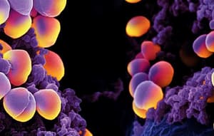 Staphylococcus aureus portador del gen mecA sensible a oxacilina (OS-MRSA): otro desafío para los laboratorios de microbiología