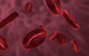 Hemoglobinuria paroxística nocturna: Una causa infrecuente y tratable de lesión renal aguda. Caso clínico