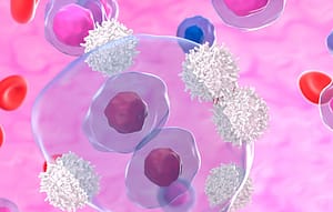 Aplicaciones de la citometría de flujo en el estudio de los síndromes linfoproliferativos crónicos
