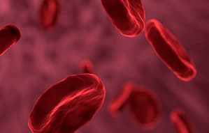 Desafíos en el diagnóstico del síndrome antifosfolípido: Más allá de los criterios convencionales